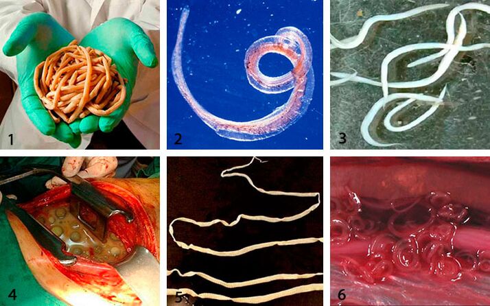 The type of parasite