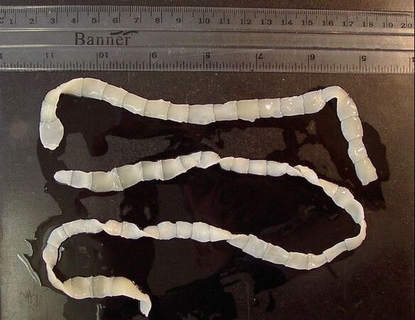 tapeworms from the human body