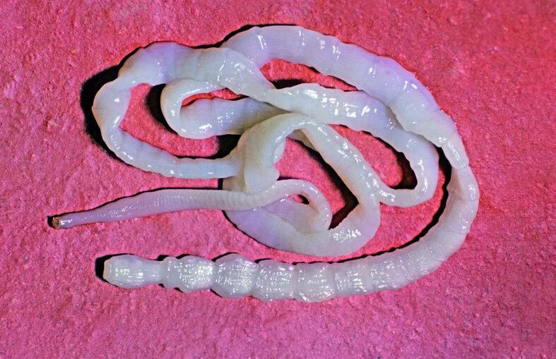 Bovine tapeworms are common intestinal helminths.