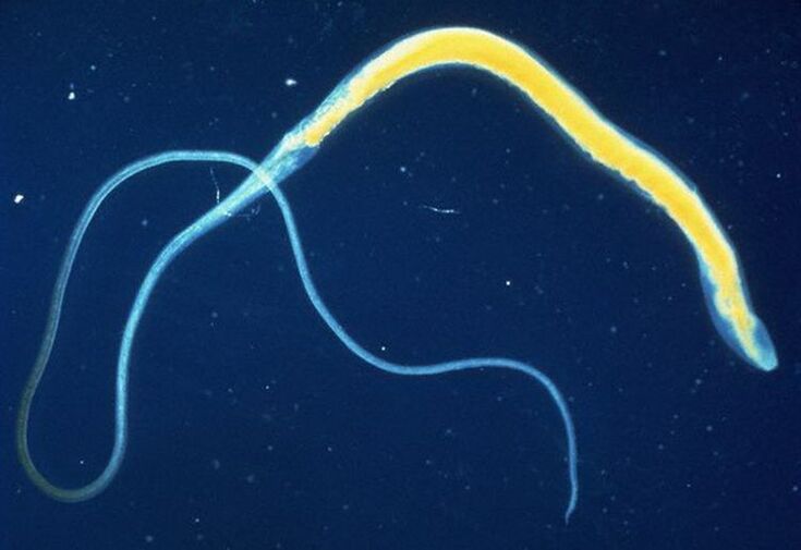 Whipworms are common intestinal parasites.
