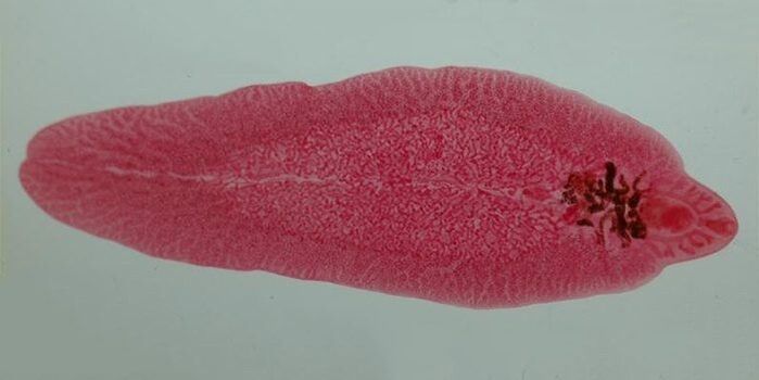 fluke worms in humans