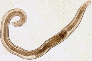 cream worms in the human body