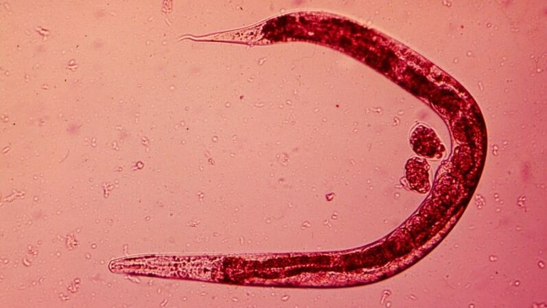 helminths from the human body