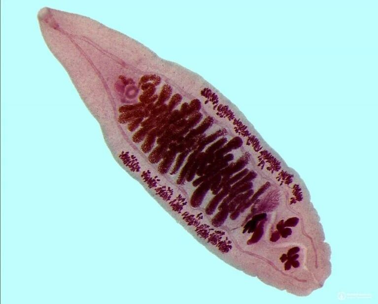 diphyllobothriasis teniarinhoz teniosis)